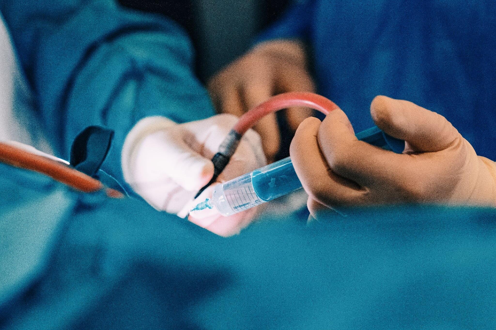 Metodas: kėdainiškei atlikta unikali minimaliai invazyvi inksto arterijos aneurizmos gydymo procedūra, ji atlikta per riešo arteriją (radialinė prieiga), naudojant specialų kraujo tėkmę nukreipiantį implantą.