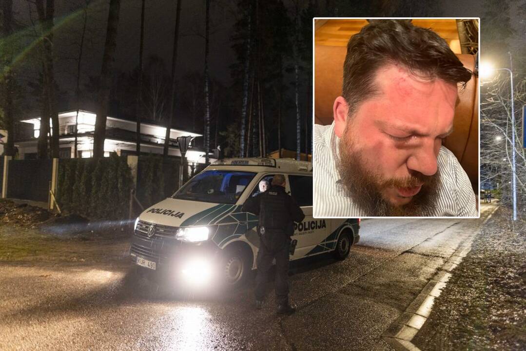 Lenkija išsiaiškino, kas galėjo užsakyti rusų opozicionieriaus užpuolimą Vilniuje