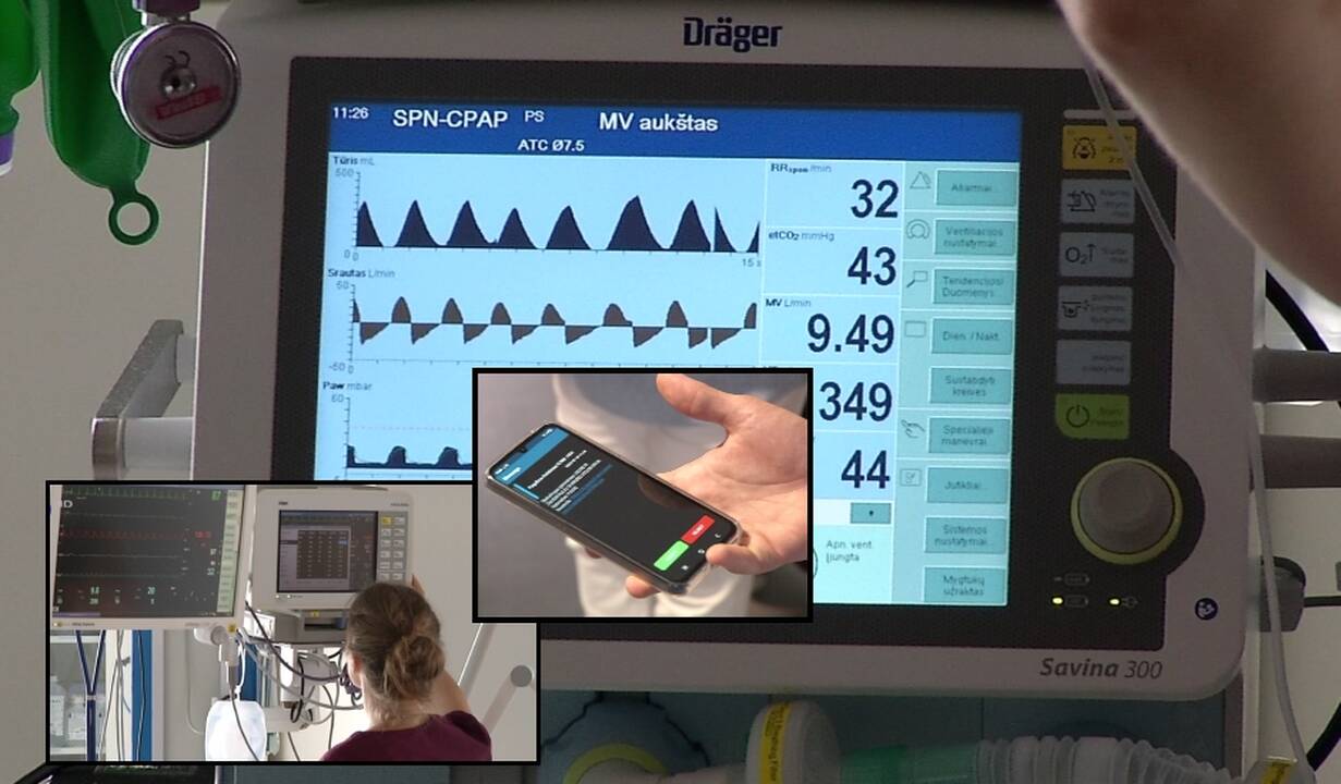 Lietuvoje – pirma tokia sistema Baltijos šalyse: išgelbės tūkstančius pacientų