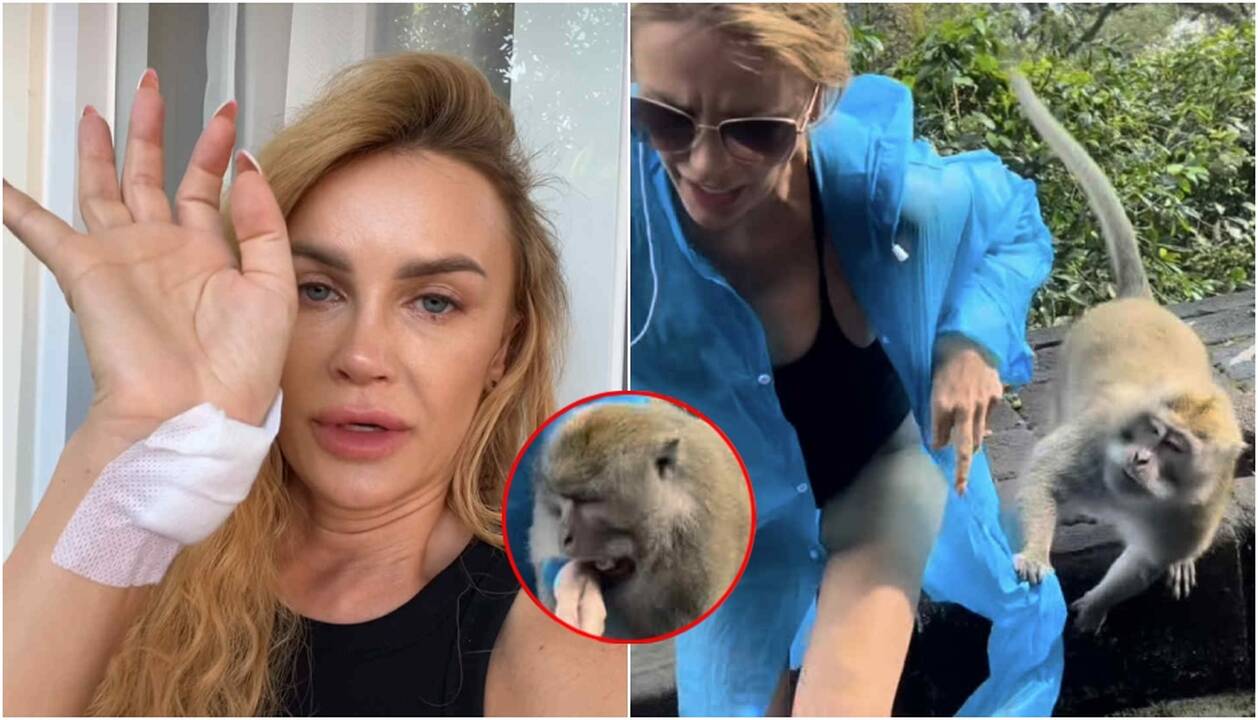 Paviešintas vaizdo įrašas: užfiksuota, kaip Kristinai Meseguer įkando beždžionė