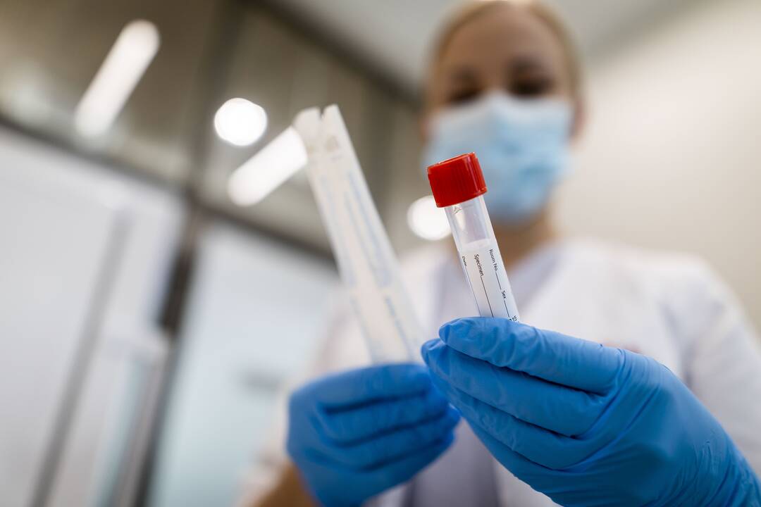 NVSC: per savaitę nuo koronaviruso mirė keturi žmonės