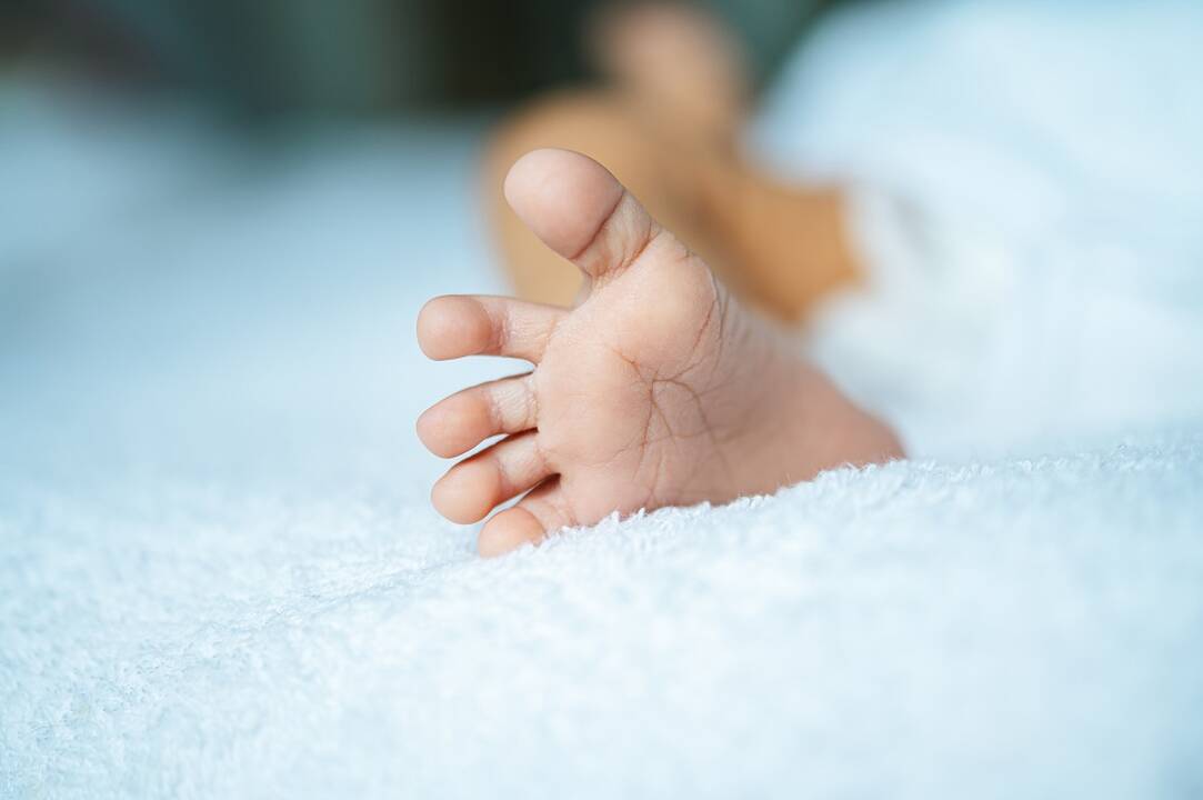 Į Klaipėdos ligoninę dėl nudegimų pristatytas pernai gimęs berniukas