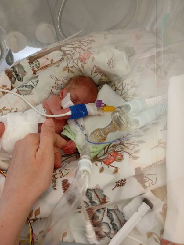 Rekordiškai mažo dydžio naujagimė