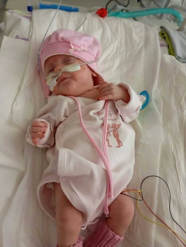 Rekordiškai mažo dydžio naujagimė