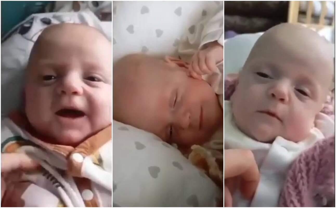 Medikai papasakojo, kaip buvo operuota rekordiškai maža naujagimė