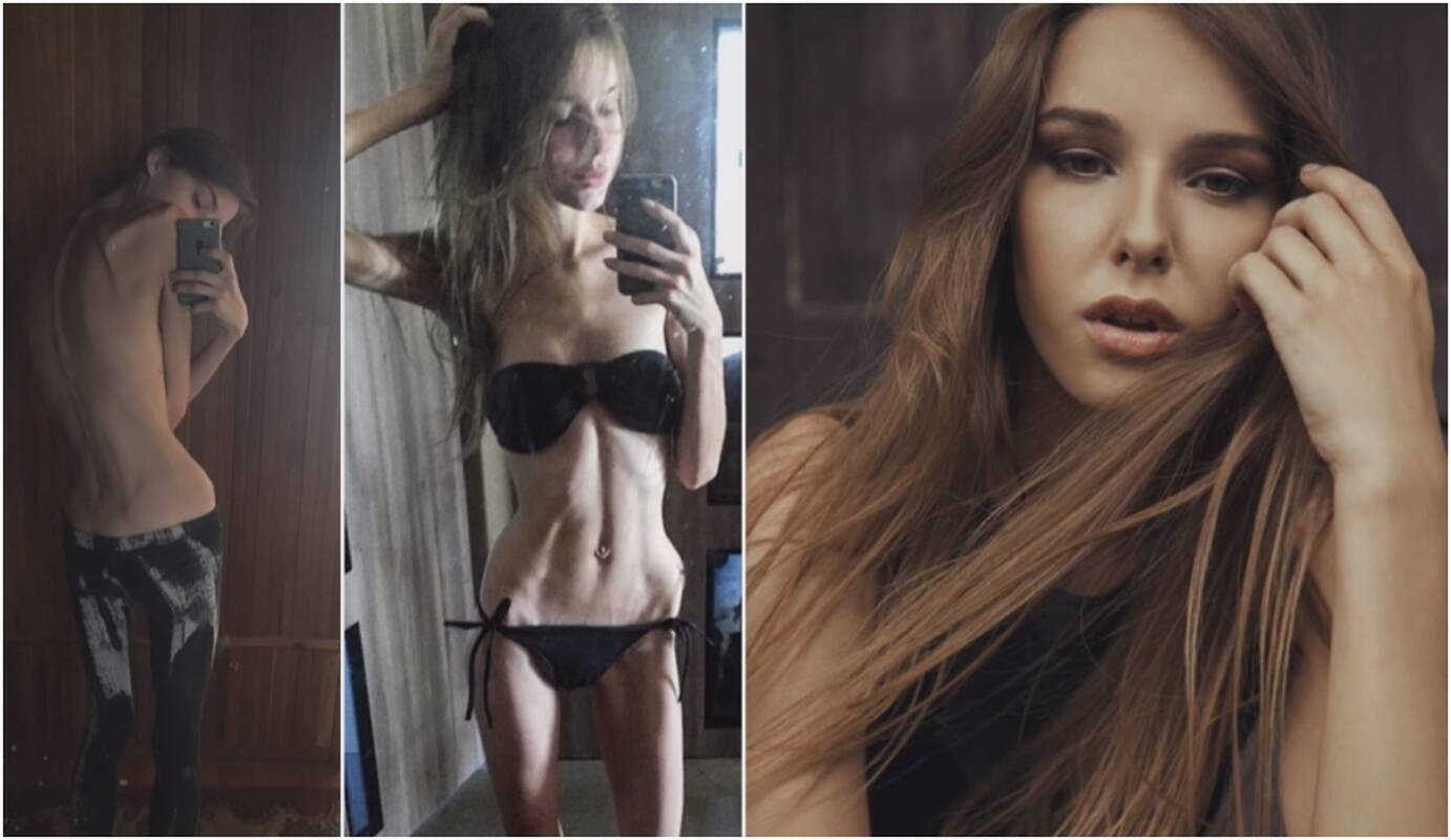 Sunkia liga sirgusi manekenė Paula: svoris buvo toks mažas, kad netikau net apatinių reklamai