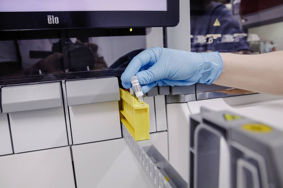 Estijoje daugėja tymų atvejų