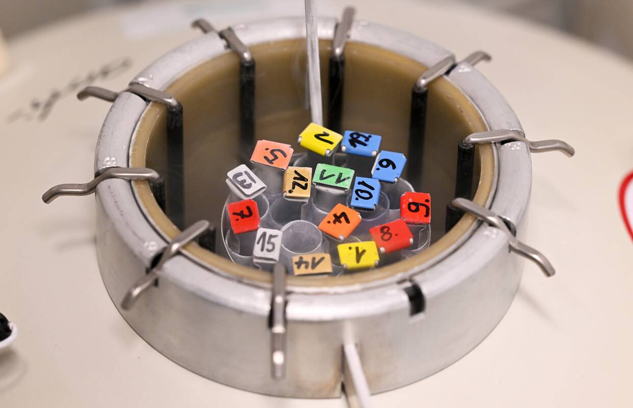 Spermos donoras su genetine mutacija galėjo turėti įtakos beveik 200 vaikų sveikatai