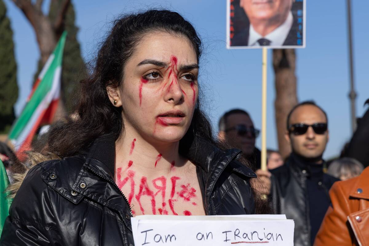 Žvilgsnis į protestų malšinimą Irane: pavojinga net vykti į ligoninę