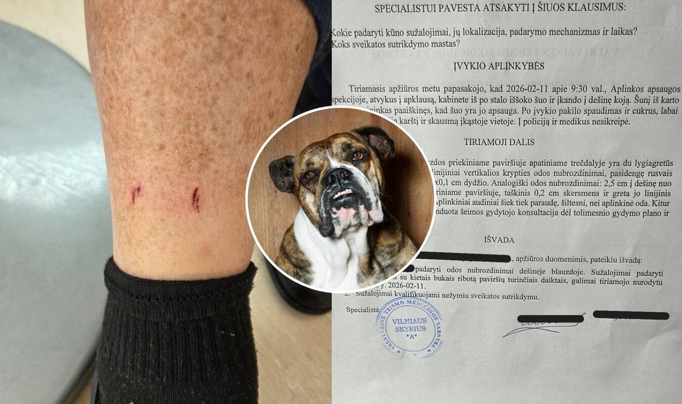 
<span>Į valstybinę įstaigą atėjusiam ūkininkui – didžiulė bėda: užpuolė pareigūno šuo</span>
