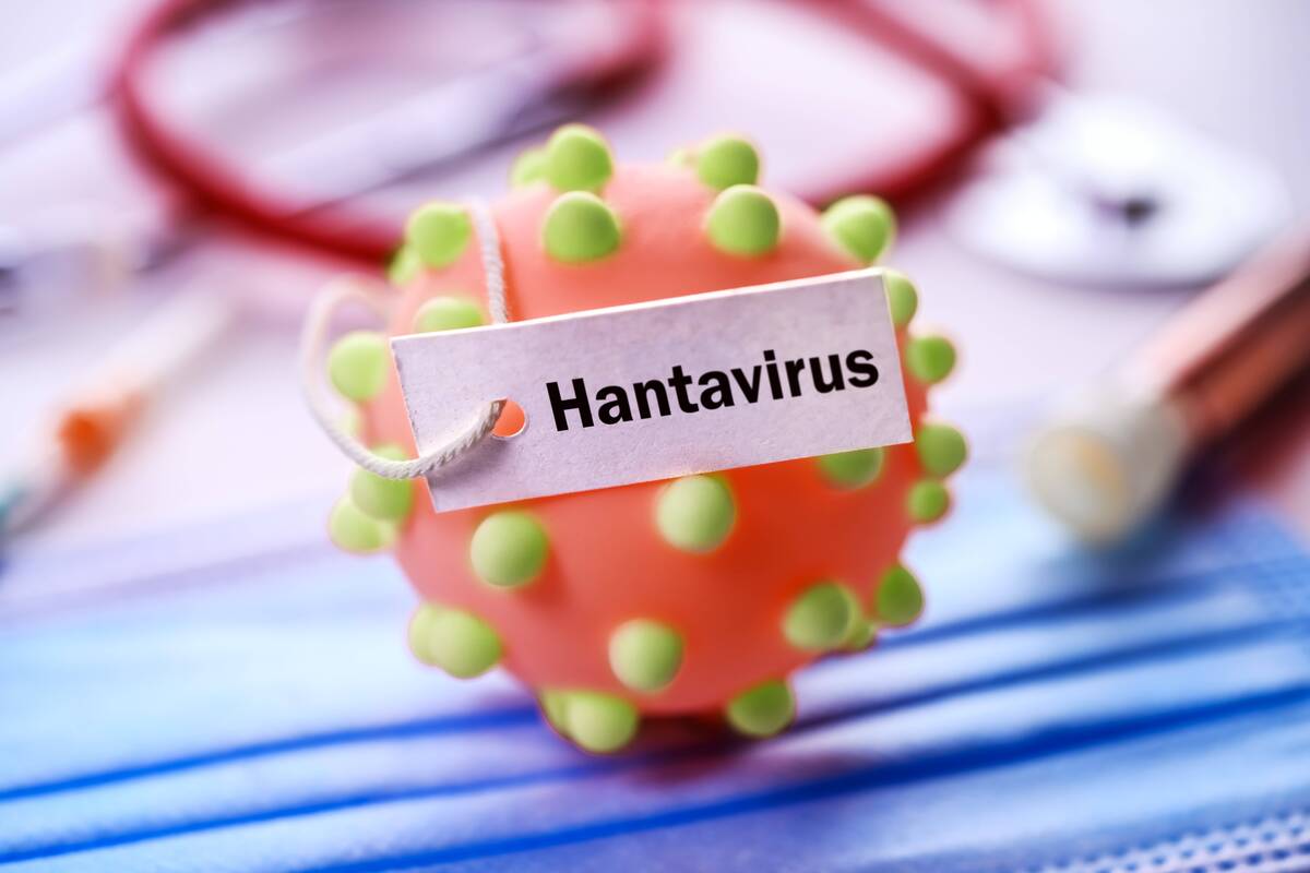 
<span>Hantavirusu užsikrėtęs kruizinio laivo keleivis gydomas Ciuriche</span>
