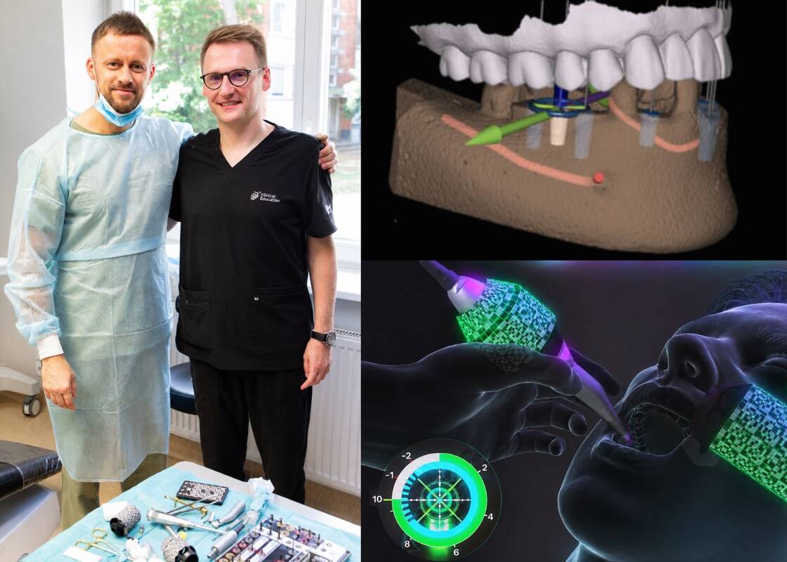 Robotinė navigacija odontologijoje: implantuojantis gyd. Andrius Jonaitis