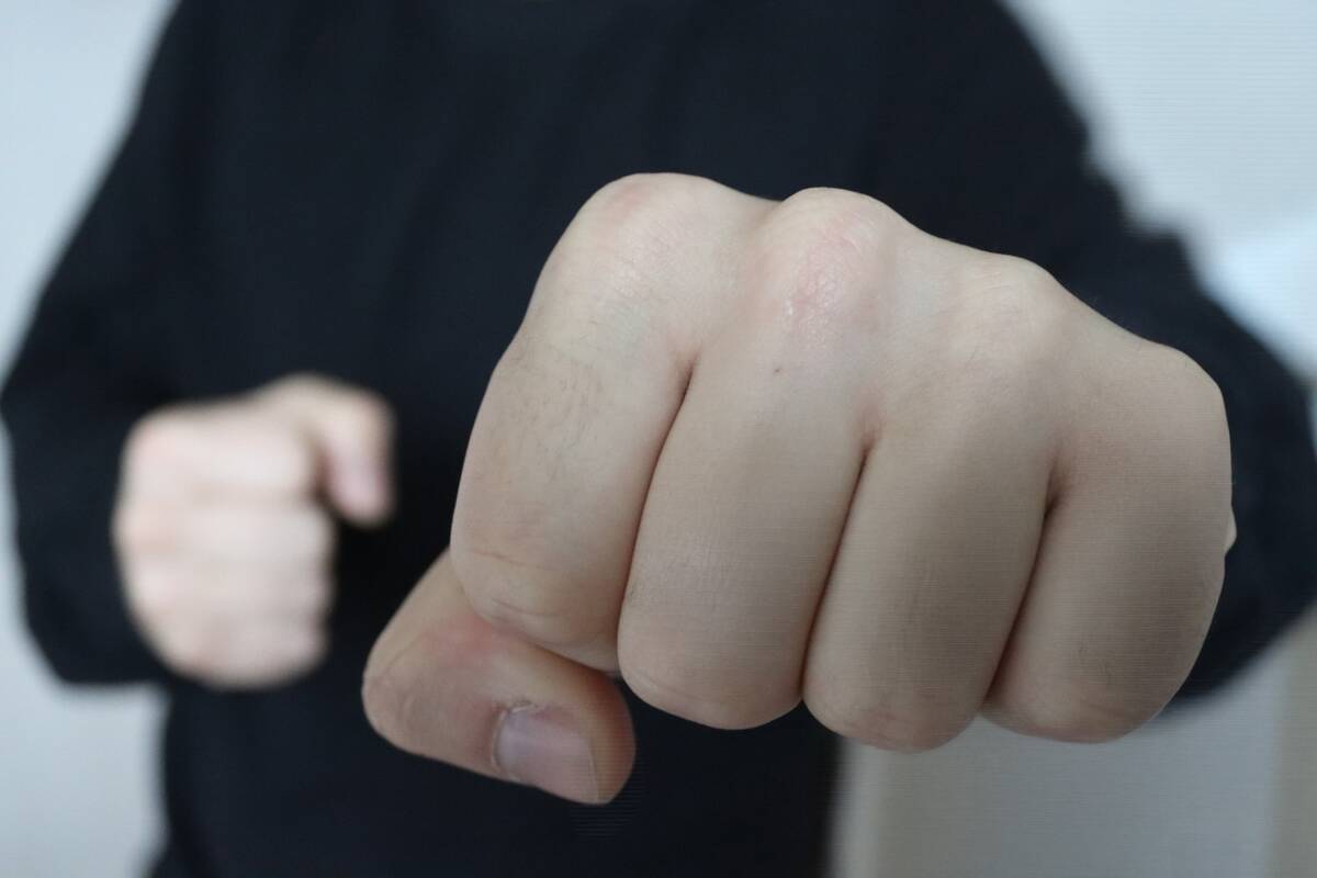 Argumentas: smūgis į veidą viduryje dienos, matant daugybei žmonių, buvo labai netikėtas.