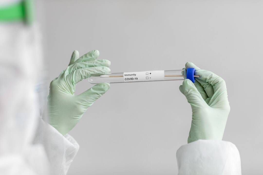 COVID-19 statistika: 234 nauji atvejai, vienas žmogus mirė
