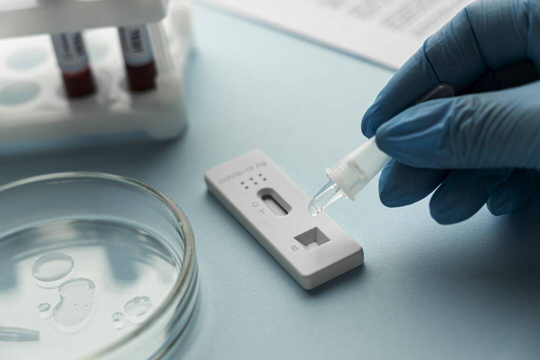 COVID-19 statistika Lietuvoje: praėjusią parą užfiksuoti 529 nauji atvejai, mirė vienas žmogus
