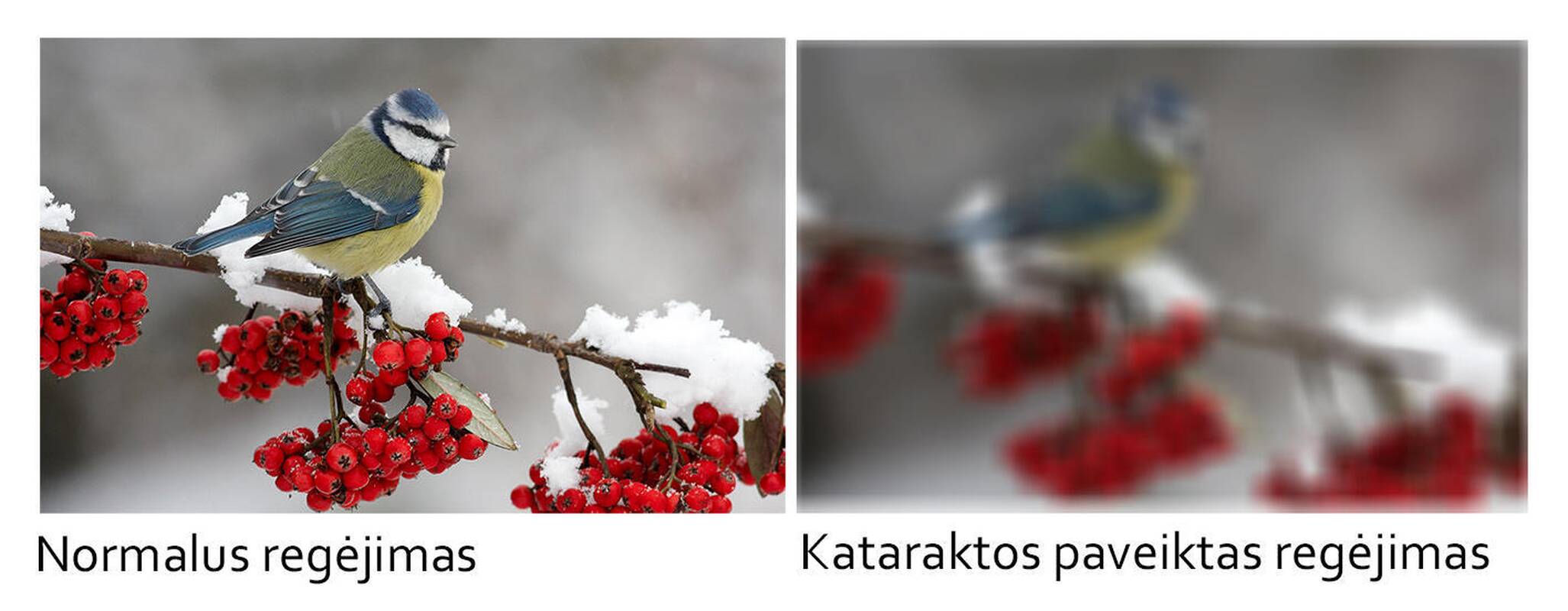 
<span>Kataraktos gydymas – tik operacija, kurios nereikia baimintis</span>
