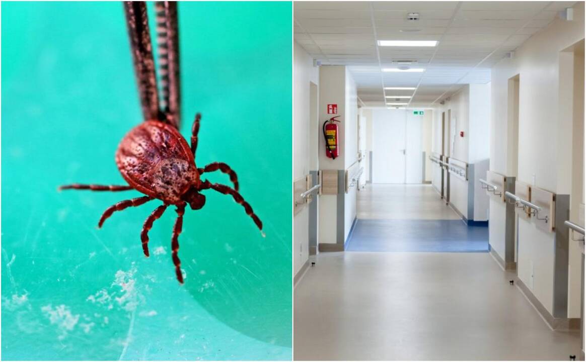Dėl erkinio encefalito trys šeimos nariai paguldyti į ligoninę: užkrėtė ne erkės?