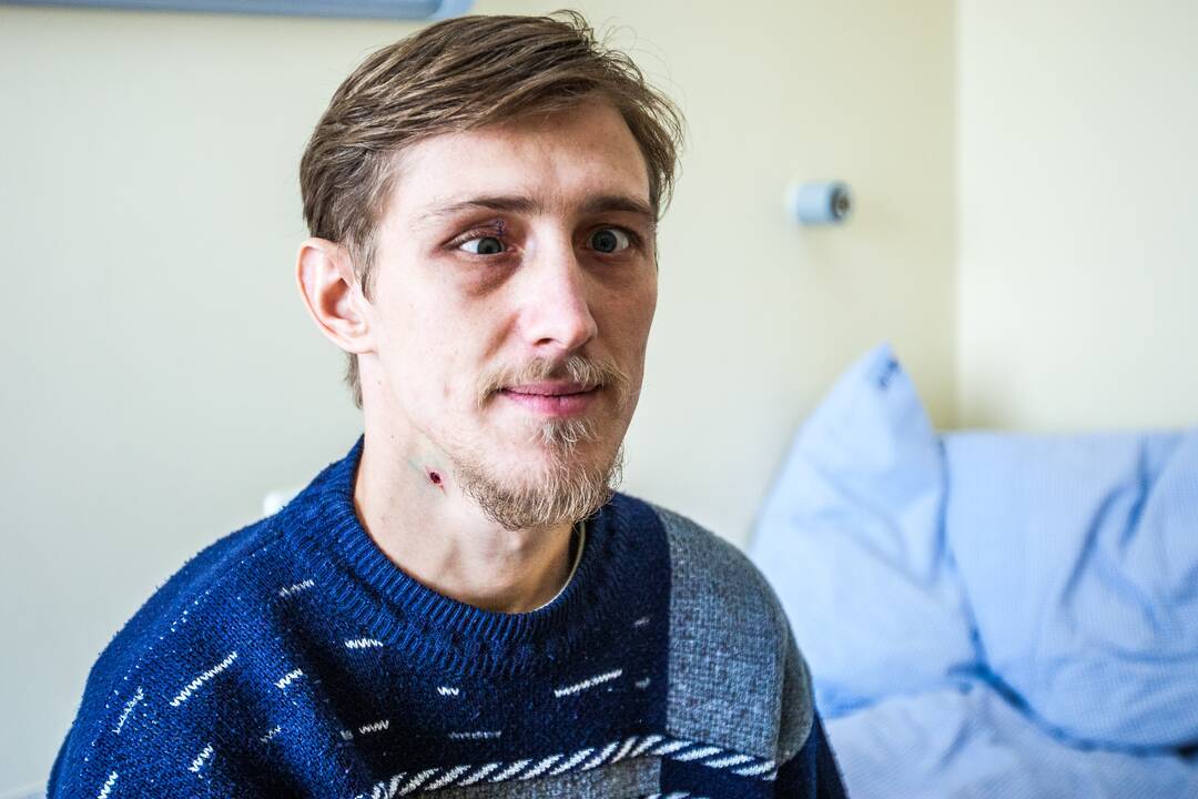 Kauno klinikose gydomas Kijeve sužalotas ukrainietis