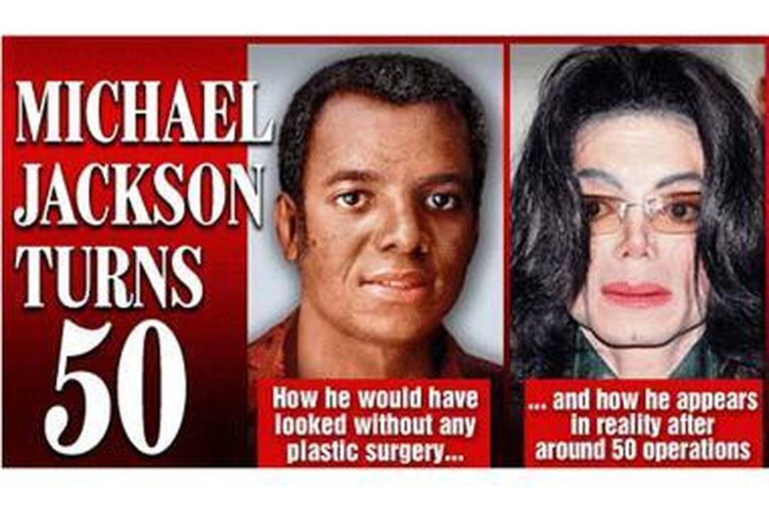 Kaip M.Jacksonas atrodytų be plastinės chirurgijos?