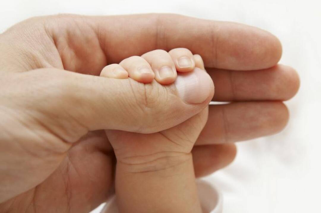 Kūdikis su reta liga gali niekada neatsimerkti