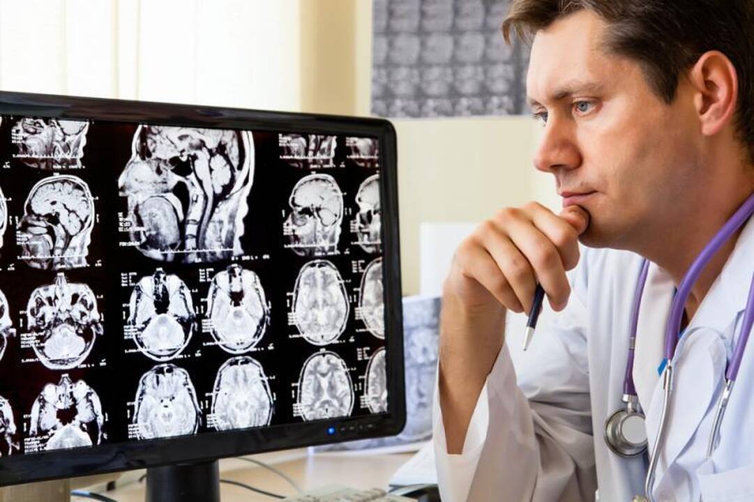 Pažink save: kaip veikia mūsų smegenys? 