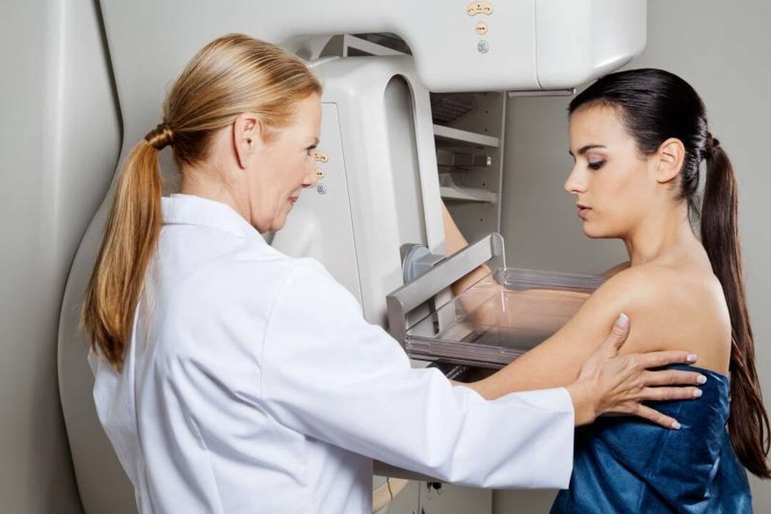 Medikai atskleidė, kaip galima išvengti krūties vėžio