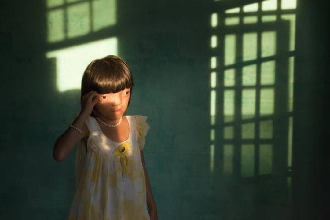 "World Press Photo" konkursą laimėjo nuo vyro smurto nukentėjusią afganę vaizduojanti nuotrauka