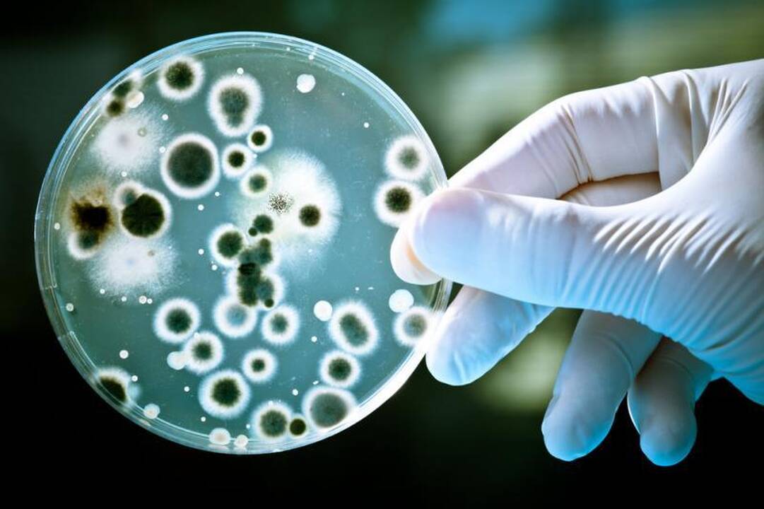 Vilniuje meningokokine infekcija užsikrėtė mokytoja