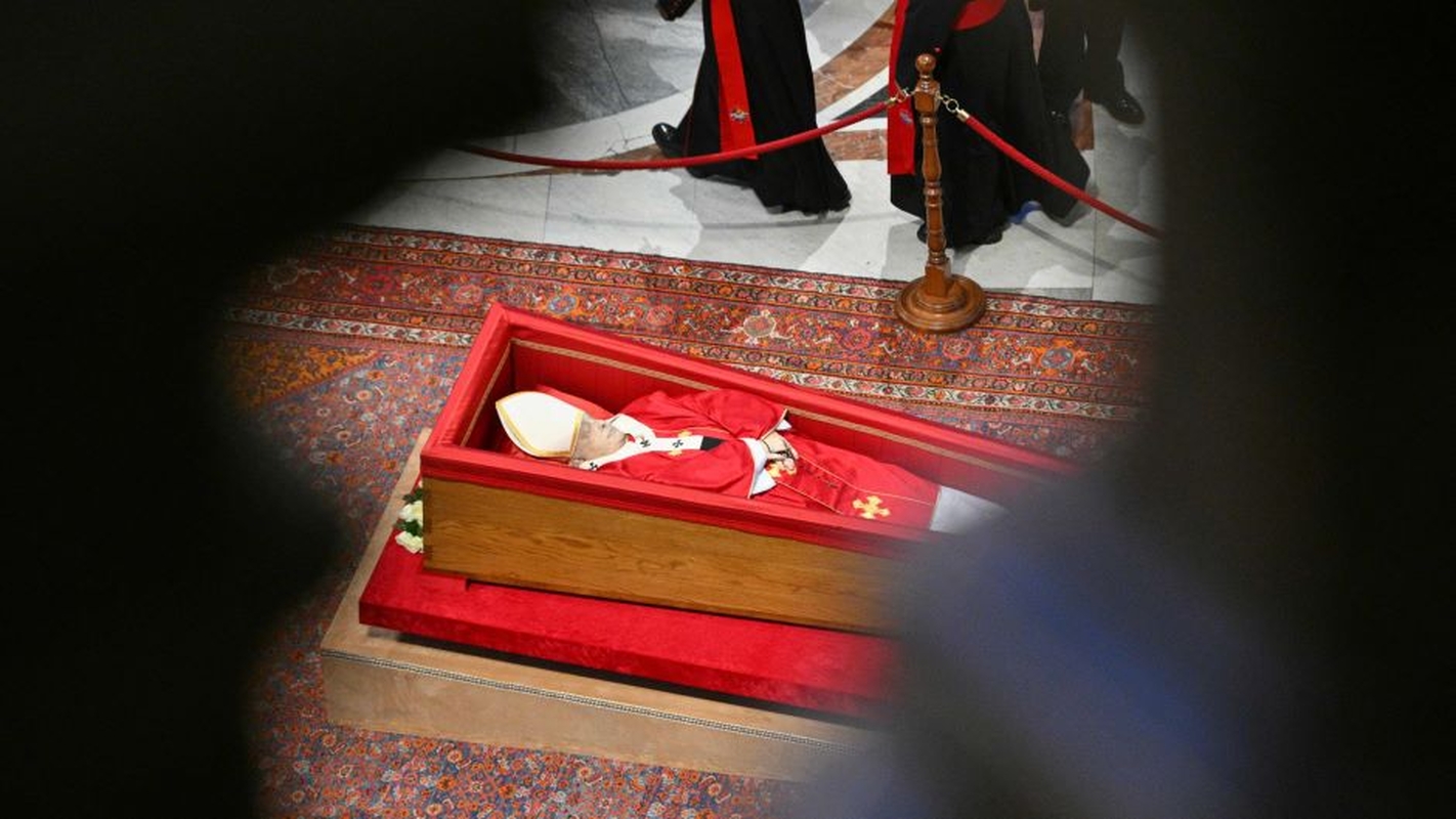 Ant popiežiaus Pranciškaus veido – mėlynė: ekspertai pateikė paaiškinimą