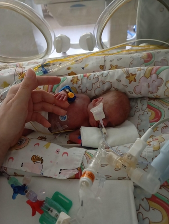 Rekordiškai mažo dydžio naujagimė