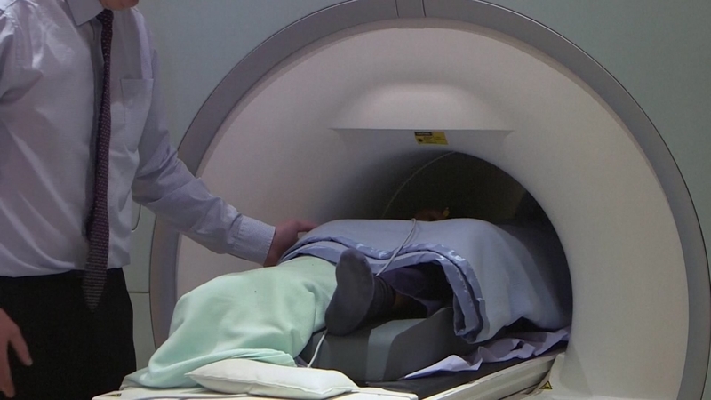Menopauzė ir smegenys: Kembridžo mokslininkų išvados kelia klausimų