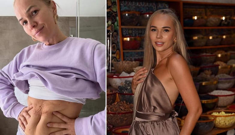 Drąsus žingsnis: Dubajuje gyvenanti influencerė Ieva Voveris parodė tai, ką dažnas slepia