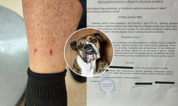 Į valstybinę įstaigą atėjusiam ūkininkui – didžiulė bėda: užpuolė pareigūno šuo