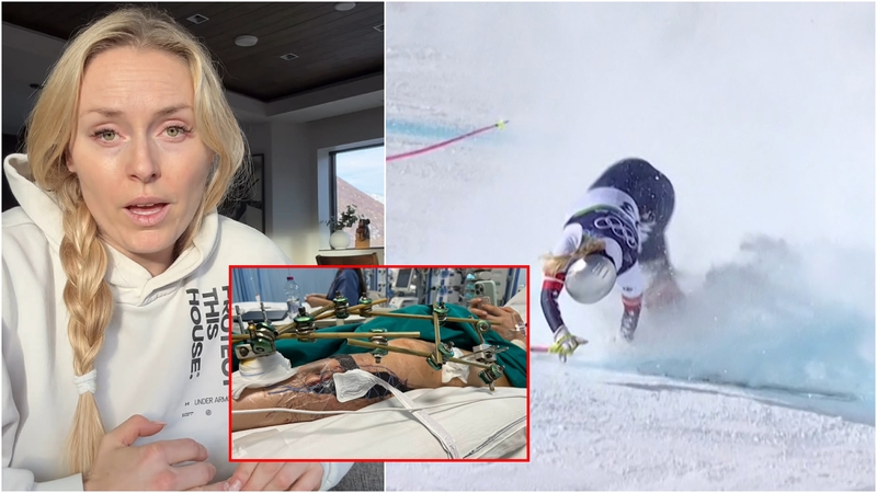 Lindsey Vonn: gydytojas išgelbėjo mano koją nuo amputacijos