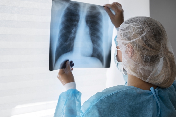 NVSC: pernai Lietuvoje nustatyti 634 nauji tuberkuliozės atvejai