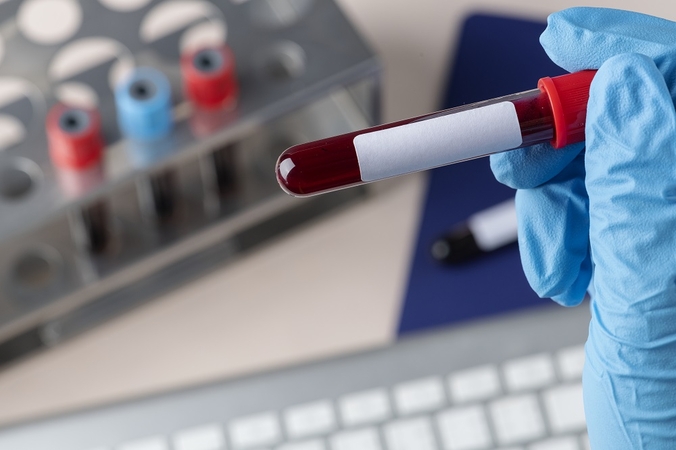 „Amžinieji“ chemikalai kraujyje: gydytojai įspėja apie galimą riziką sveikatai