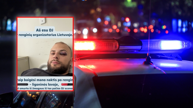 Vilniaus centre – išpuolis prieš žinomą didžėjų: po incidento atsidūrė ligoninėje