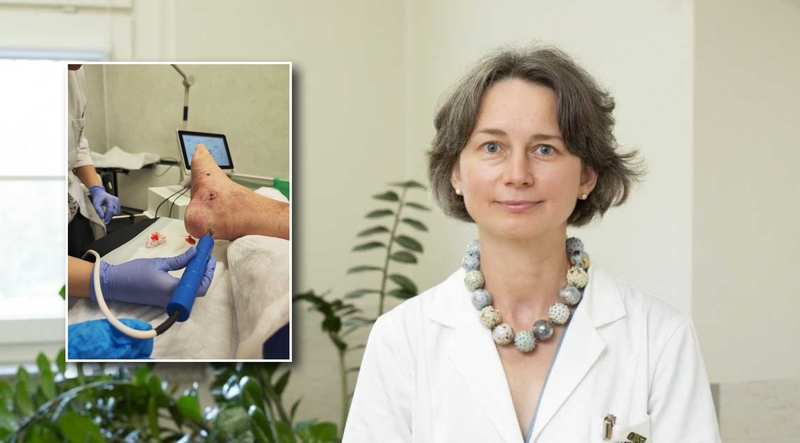 Kauno klinikose pritaikyta inovatyvi elektrochemoterapija: padėjo suvaldyti retą onkologinę ligą