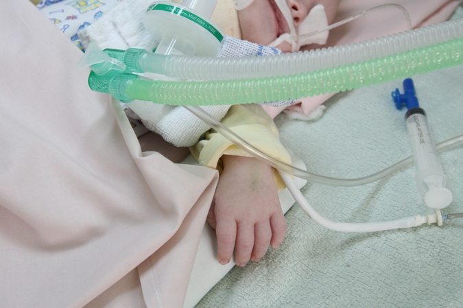 Padariniai: mažamečiui, patyrusiam stiprią elektros iškrovą, galėjo grėsti ypač sunkios pasekmės ar net mirtis.
