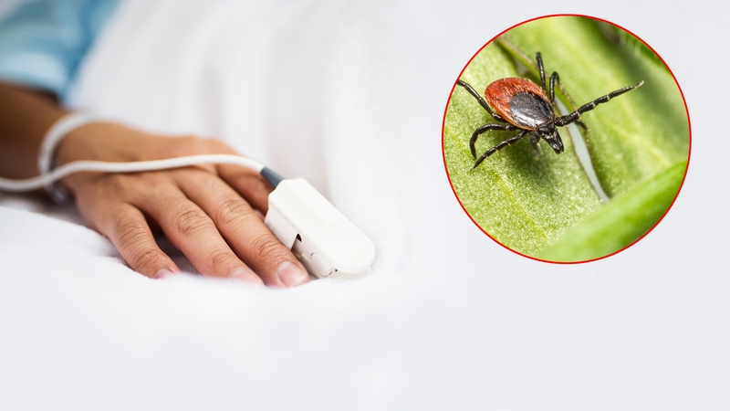 Santaros klinikų reanimacijos skyriuje – vien erkinio encefalito pacientai