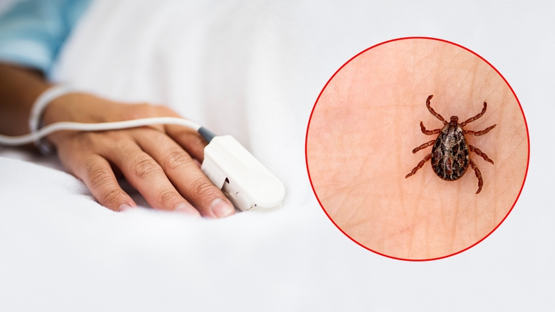 Po erkės įkandimo moters gyvenimas virto košmaru