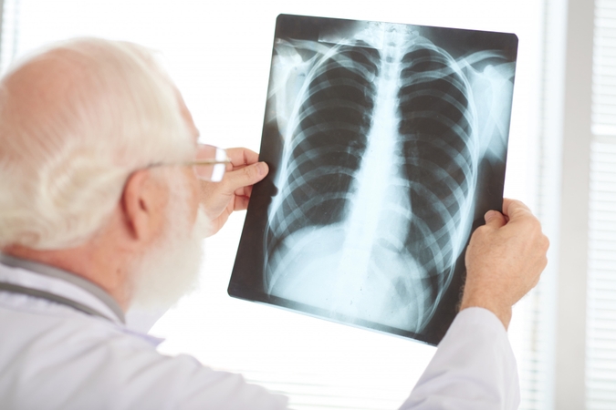 Kauno klinikų gydytoja apie plaučių fibrozę: kada dusulys gali įspėti apie rimtą ligą?