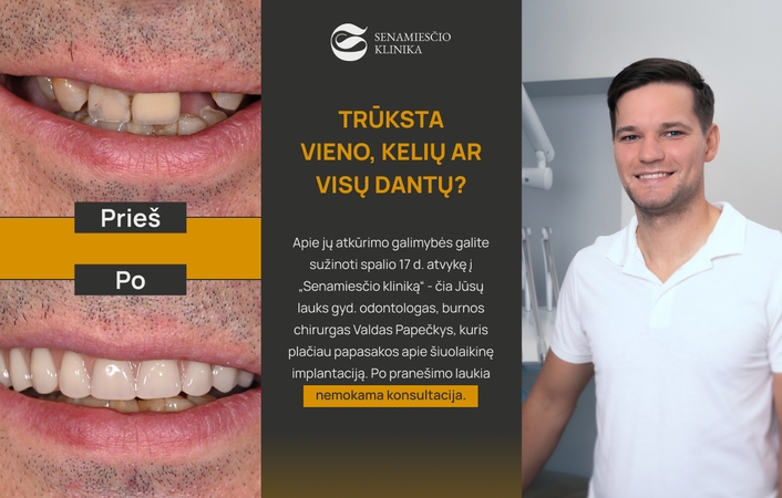 Kai išimamas protezas tampa našta: kaip šiandien atkuriami viso žandikaulio dantys