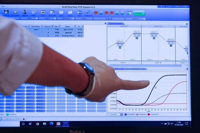 Prancūzijoje patvirtinta daugiau kaip 10 tūkst. naujų koronaviruso atvejų