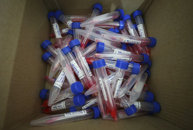 Latvijoje nustatyti 89 nauji COVID-19 atvejų, trys pacientai mirė