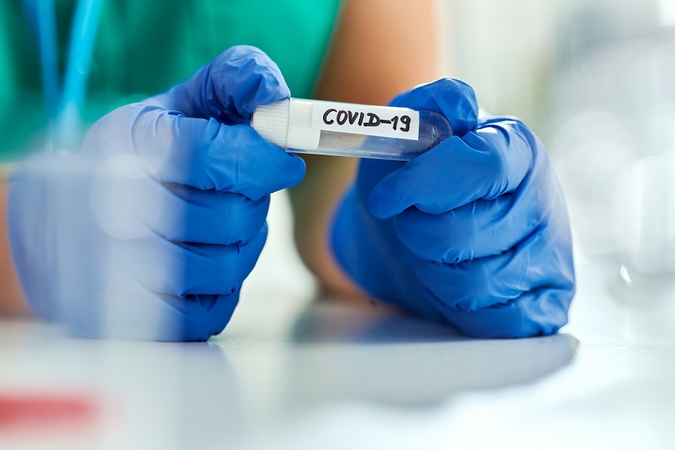 COVID-19 statistika: 34 nauji atvejai, mirčių nefiksuota