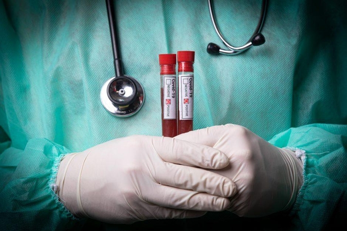 Patvirtintas 30-asis mirties nuo koronaviruso infekcijos atvejis