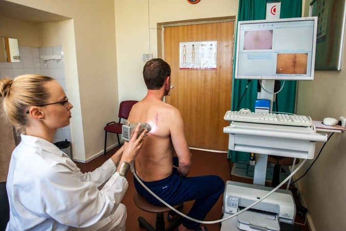4 faktai apie dažniausiai diagnozuojamą odos vėžio formą