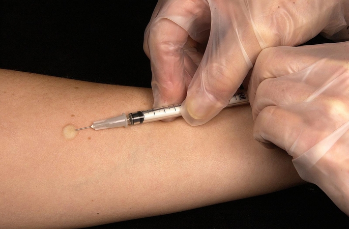 Pernai Lietuvoje tuberkuliozė nustatyta 47 vaikams