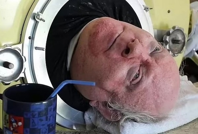 JAV mirė 78 metų sulaukęs „žmogus su geležiniais plaučiais“